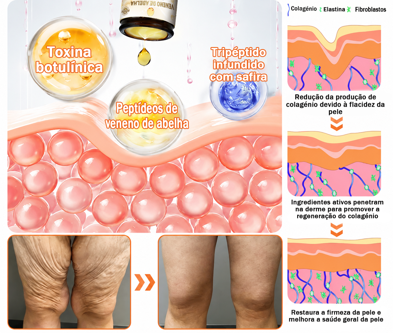 🌿🔥 𝑻𝑳𝑶𝑷𝑨® Creme de Tratamento da Pele com Veneno de Abelha (👨‍⚕️ Com Certificação CE) 👍✅