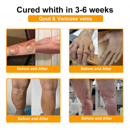 XRLXRL® Bee Venom Pain-Relief Bone Healing Cream 🇺🇸(Specially for older adults)