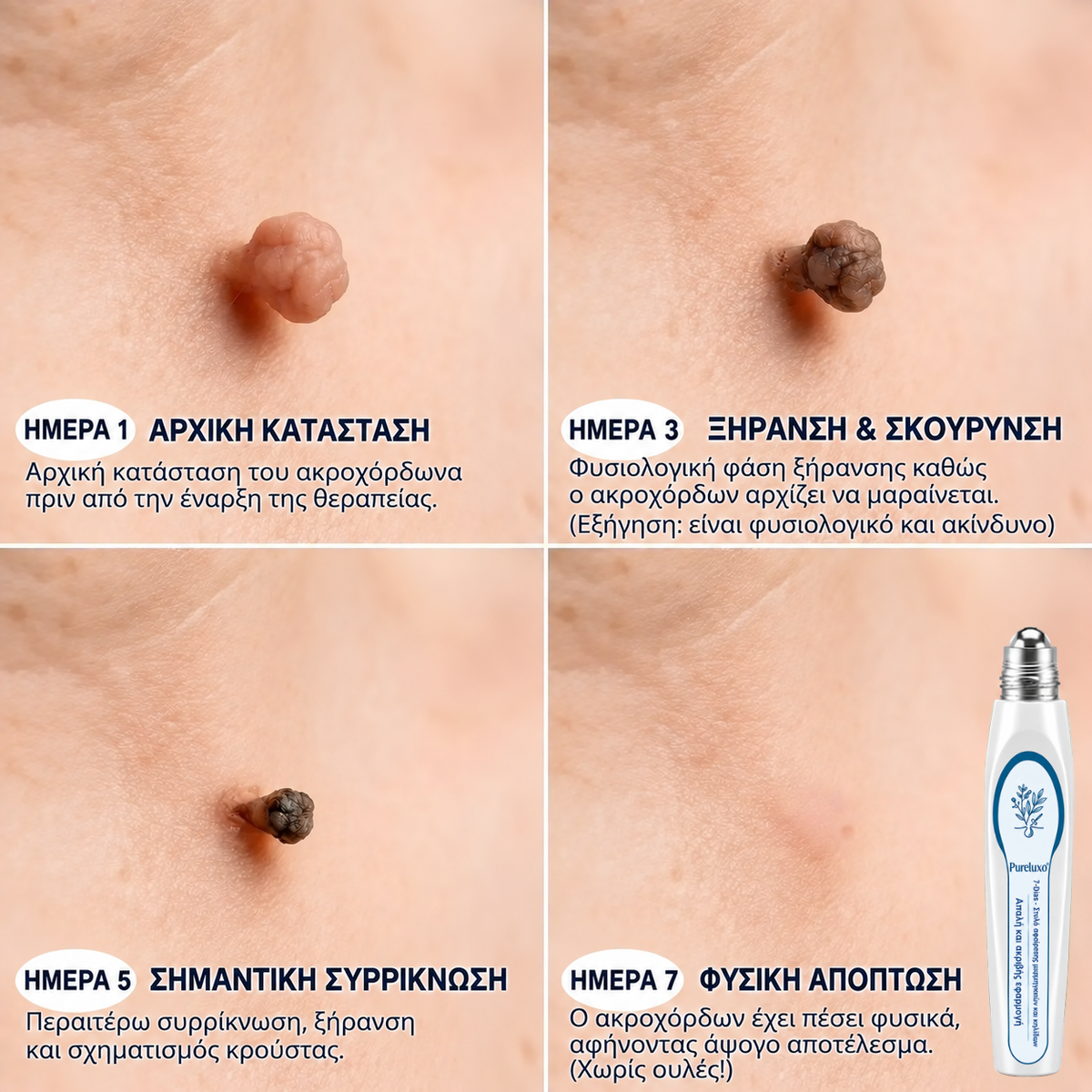 𝑷𝒖𝒓𝒆𝒍𝒖𝒙𝒐® Premium Εφαρμογέας Roll-on 🌿