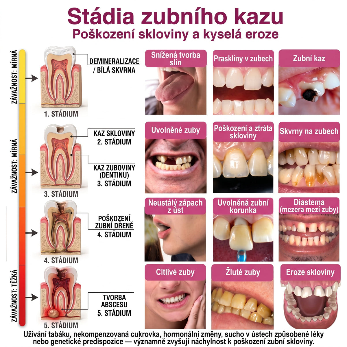 Rolimey® DenPerm – Přírodní gel pro vyplňování defektů skloviny a ošetření kariézních lézí🎁