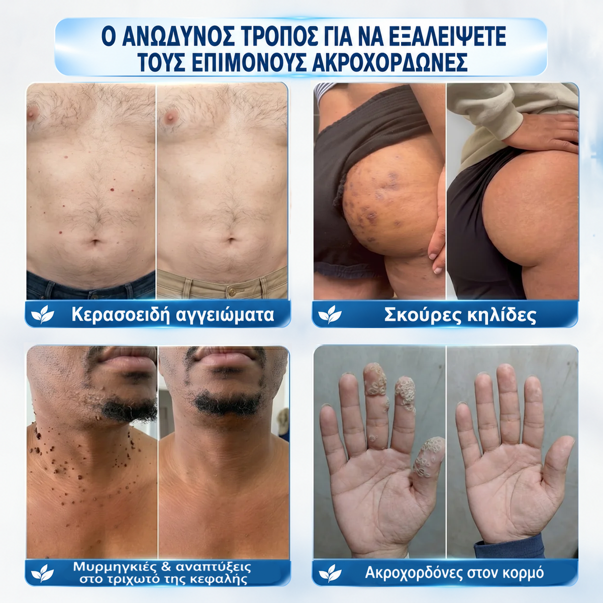 𝑷𝒖𝒓𝒆𝒍𝒖𝒙𝒐® Premium Εφαρμογέας Roll-on 🌿
