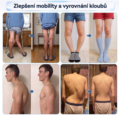 🌿XRLXRL®🪄 TECHNOLOGIE ORTOPEDICKÉ REGENERACE NOVÉ GENERACE · 0,05mm mikrojehličkový váleček pro obnovu kostí a kloubů