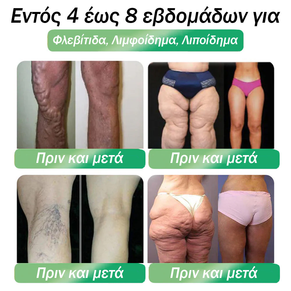 Επίσημο Κατάστημα |👨‍⚕️ 𝑫𝑨𝑨𝑴𝒀® 𝑬𝒙ωγενής ρόφημα GLP-1 έξι σε ένα (Μόνο μία δόση την ημέρα, ορατές αλλαγές σε 7 ημέρες) 🌿 Για παχυσαρκία, καρδιαγγειακή υγεία, διαβήτη, υπνική άπνοια, προβλήματα αρθρώσεων και πολλά ακόμα.