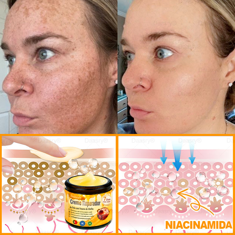 👨‍⚕️Certificado CE: Daasry® Creme Restaurador de Pele com Veneno de Abelha — Efeito Tipo Botox