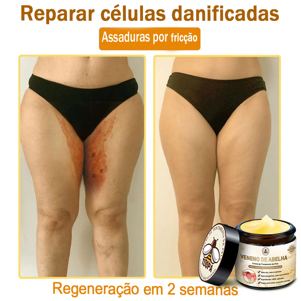 🌿🔥 𝑻𝑳𝑶𝑷𝑨® Creme de Tratamento da Pele com Veneno de Abelha (👨‍⚕️ Com Certificação CE) 👍✅