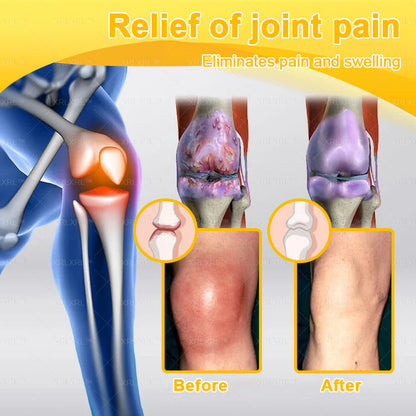 XRLXRL® Bee Venom Pain-Relief Bone Healing Cream 🇺🇸(Specially for older adults)